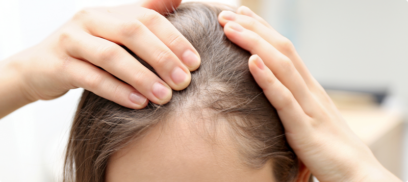 Czego brakuje w organizmie, kiedy wypadają włosy?