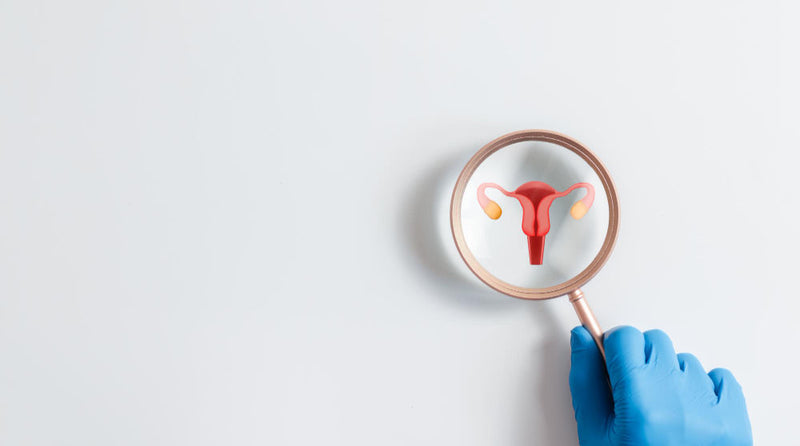 PCOS a wypadanie włosów - jak zespół policystycznych jajników wpływa na kondycję włosów