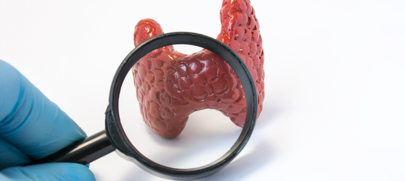 Włosy a Hashimoto – czy da się zatrzymać wypadanie włosów?