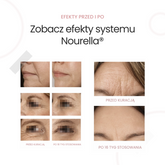 Proteoglikany dla skóry - Nourella® (suplement + krem)